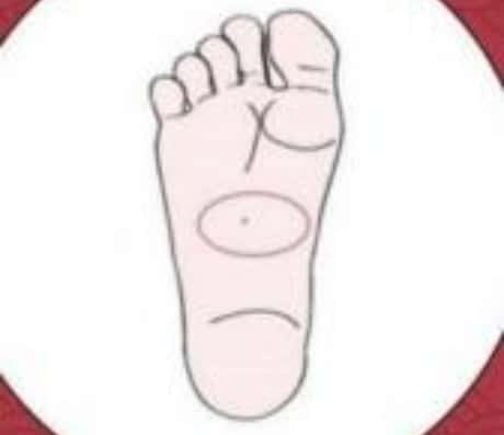 女人脚底痣相解析：痣的位置暗示贵人命？