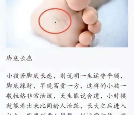 脚掌心有痣的男人：一种神秘的身体印记