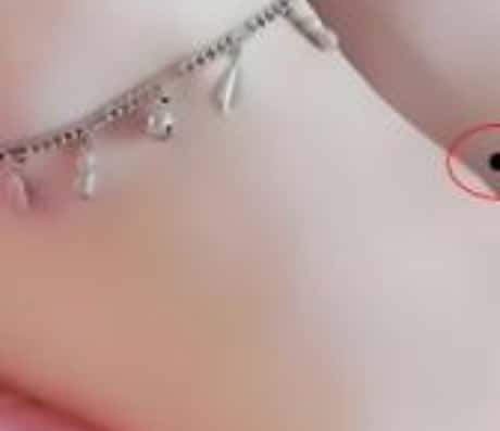 脚踝长痣：一篇文章解析