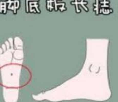 脚心有痣寓意好吗