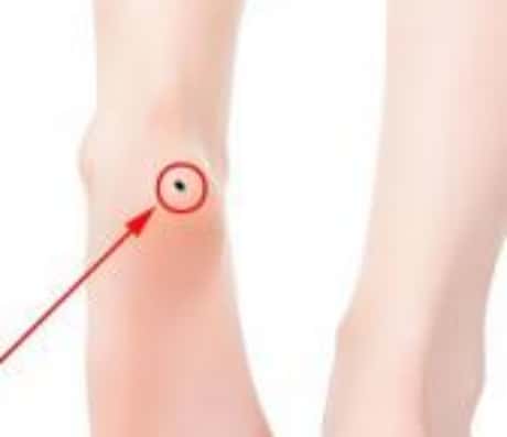 脚踝有痣的人：神秘的体征与文化的交融