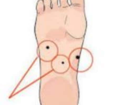 女人右脚心有痣：神秘还是巧合？