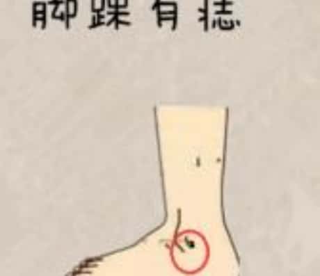 脚踝上的痣：探寻其背后的故事