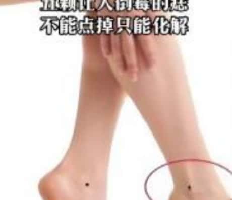 脚踝上的痣：健康信号还是皮肤老化迹象？