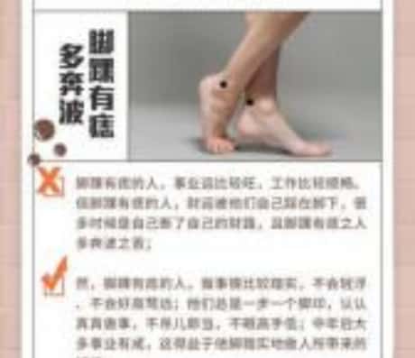 脚踝长痣好不好