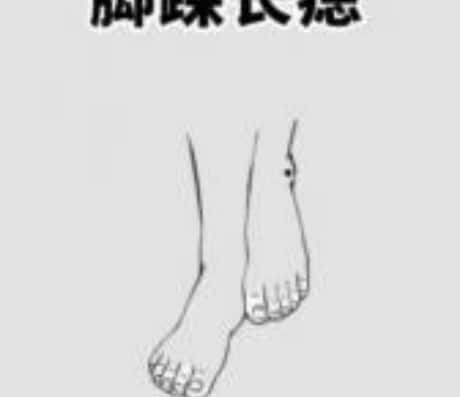 脚踝上的痣：一种独特的身体印记