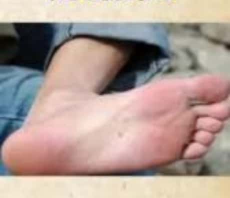 脚下有痣的含义是什么？