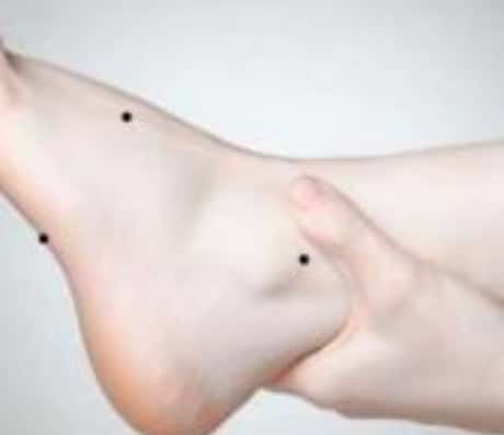 女人左脚痣的十大福气解读