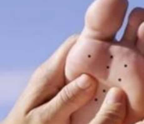 脚心有痣的寓意解读